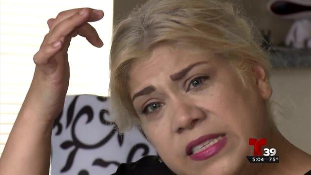 Acude al salón de belleza y sufre quemaduras en la cabeza