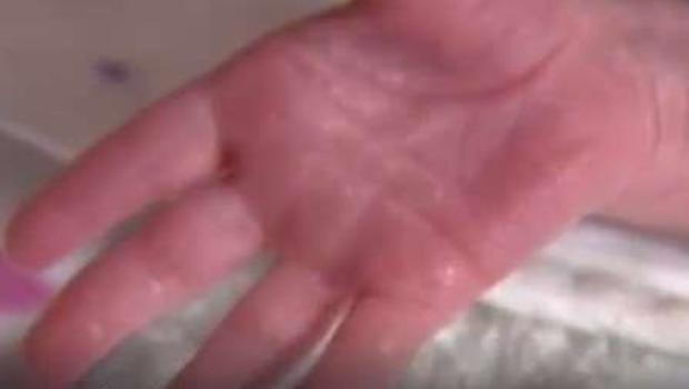 [TLMD - LV] Nace primera bebé de útero de donante fallecida