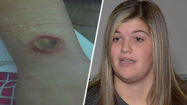 Se quedó dormida con celular y cargador enchufado y esto fue lo que pasó