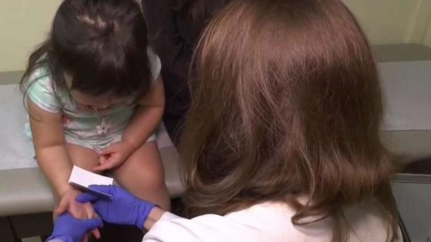 Nueva prueba para detectar alergias