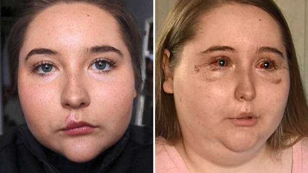 [TLMD - LV] Joven asegura que brutal diarrea la dejó ciega