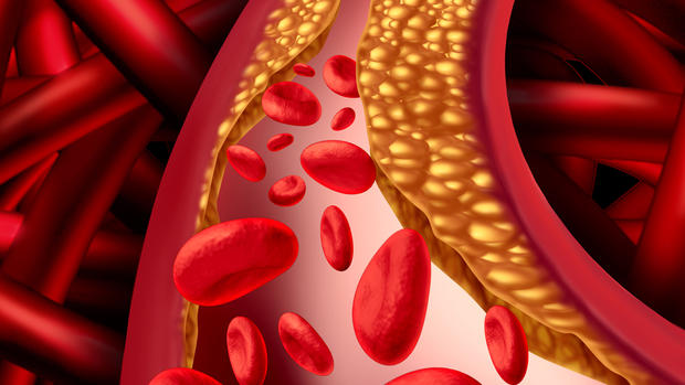Qué es el colesterol, el asesino que llevas en la sangre