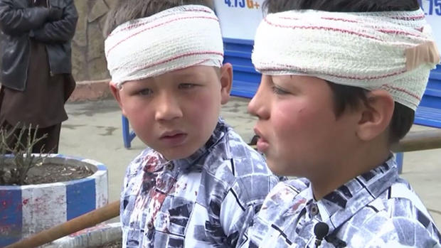 Bombazos letales sacuden Kabul; hay niños heridos