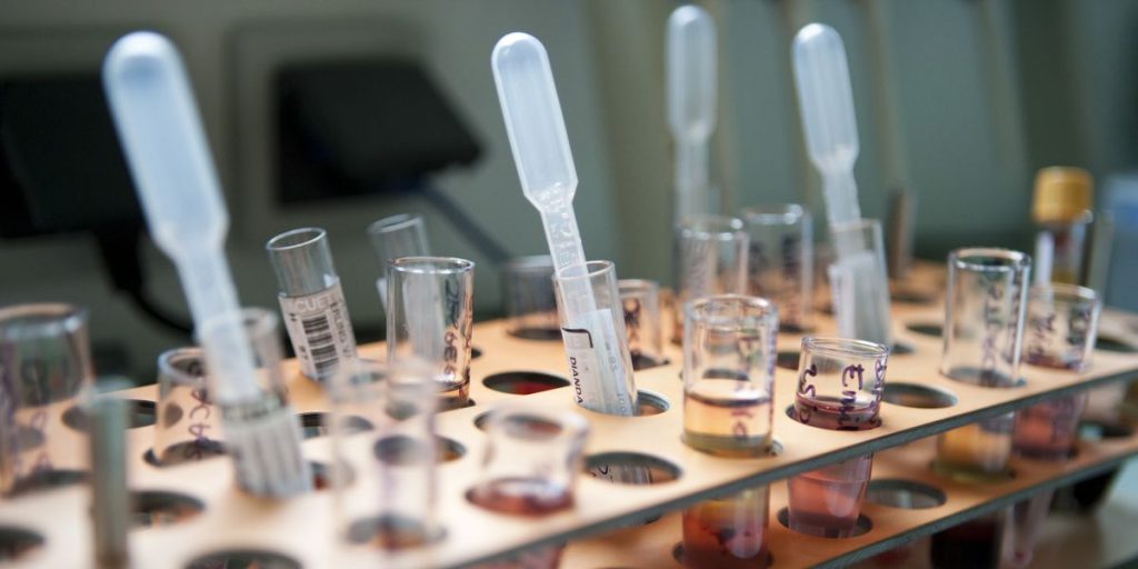 Un paciente con VIH ha pasado a remisión: solo el segundo caso en el historial médico registrado