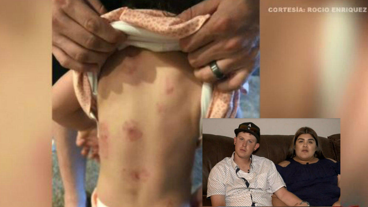 Pequeña presuntamente recibe ocho mordiscos en guardería