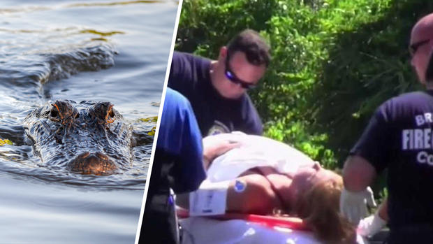 [TLMD - MIA] Se bañaba en un lago cuando fue atacada por un cocodrilo