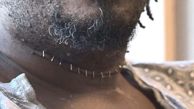 Conductor de Uber se recupera tras ser degollado