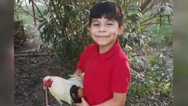 [TLMD - McAllen] Solicitan apoyo de la comunidad por quemaduras de menor