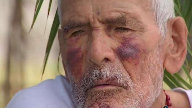 [TLMD - LA] Arrestan a la mujer que golpeó brutalmente con un ladrillo a un abuelito