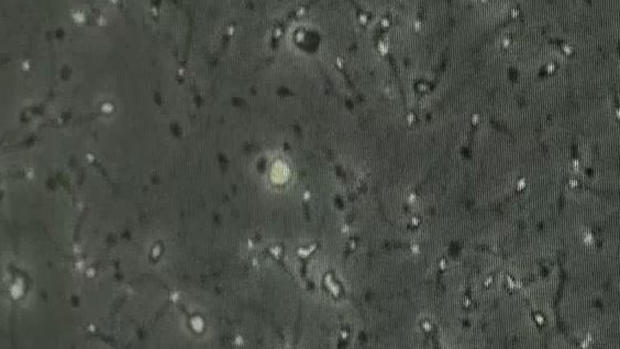 Increíble: el semen congelado y la reproducción más allá de la Tierra