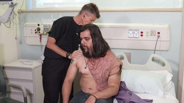 [TLMD - LA] Médicos esperan cambiar la vida de hombre con rara enfermeda