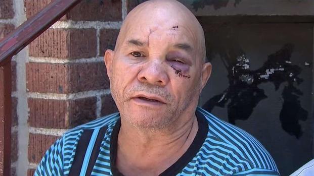 [TLMD - NY] NYPD: ataque a dominicano captado en video