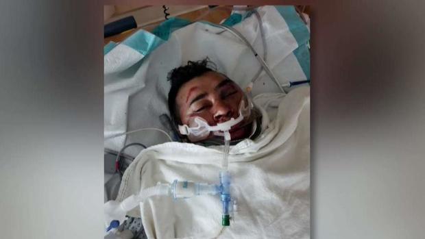 [TLMD - NY] Termina con soporte vital tras brutal golpiza