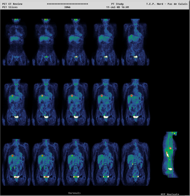 GettyImages 151045631