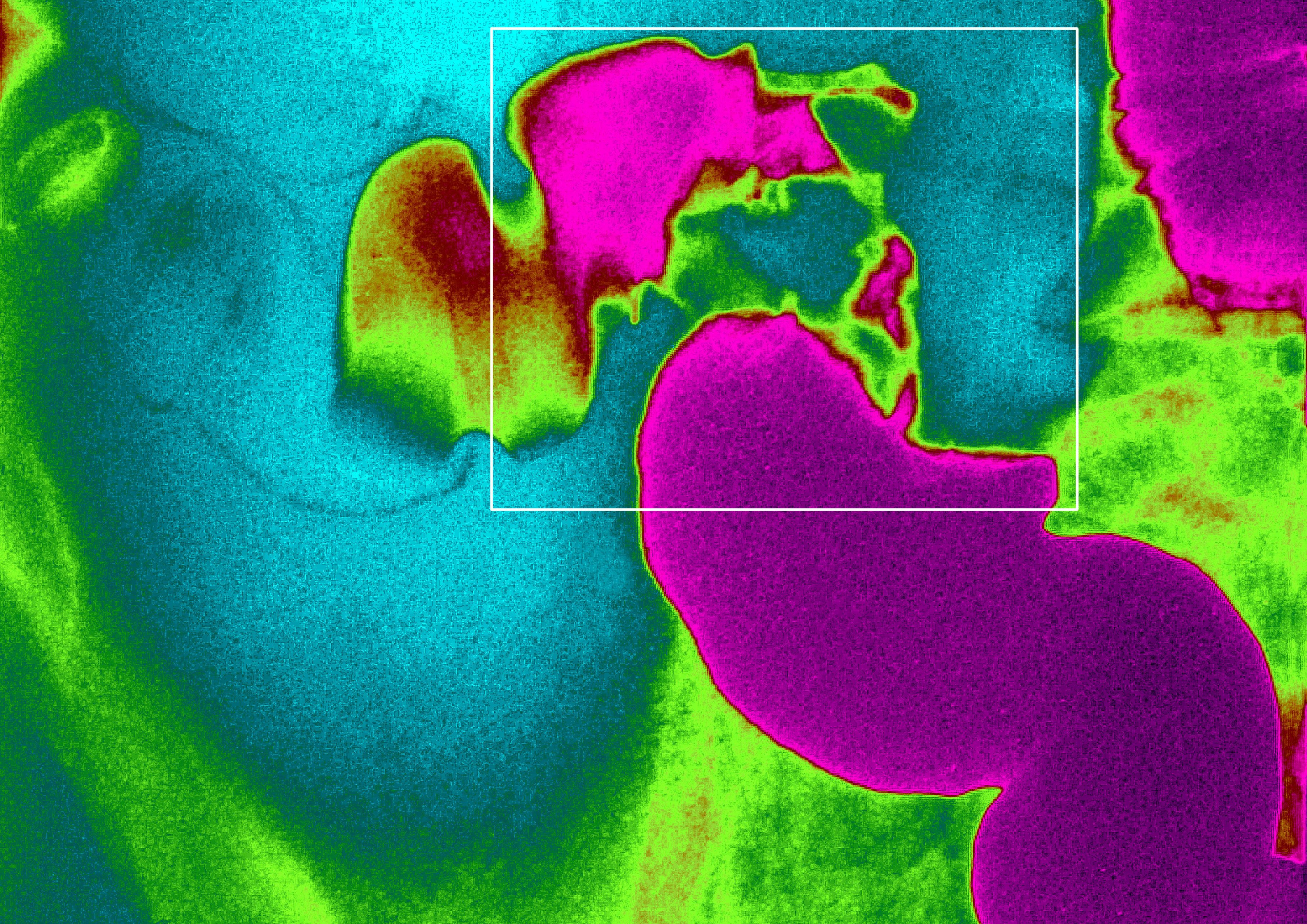 GettyImages 179793659