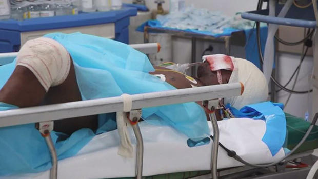 Hay más muertos por ataque a centro migrante