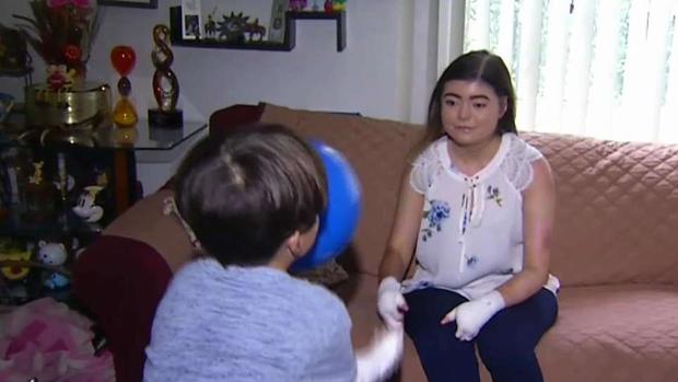 Una enfermedad que afecta la piel de las personas