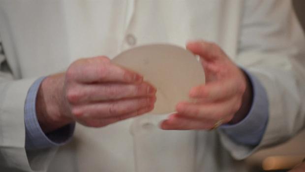 Retiran implantes de seno por riesgo de cáncer