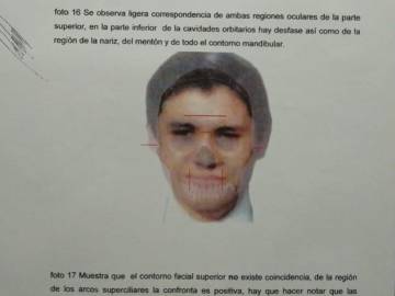 Imagen del análisis forense tras la exhumación.