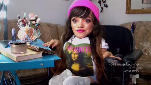 Joven con “huesos de cristal” supera la adversidad