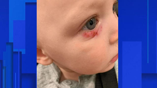 Madre asegura que Facebook salvó a su hijo de una ceguera