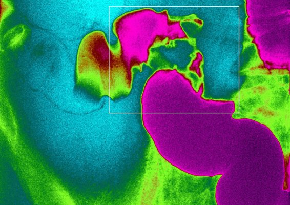 ArsenalBio emerge del sigilo con $ 85 millones y un equipo de ensueño para combatir el cáncer