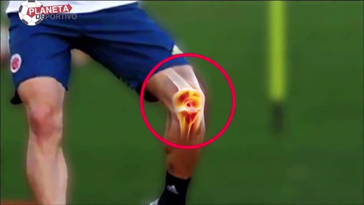 James se lesiona y queda descartado para el partido de Colombia ante Perú James se lesiona y queda descartado para el partido de Colombia ante Perú