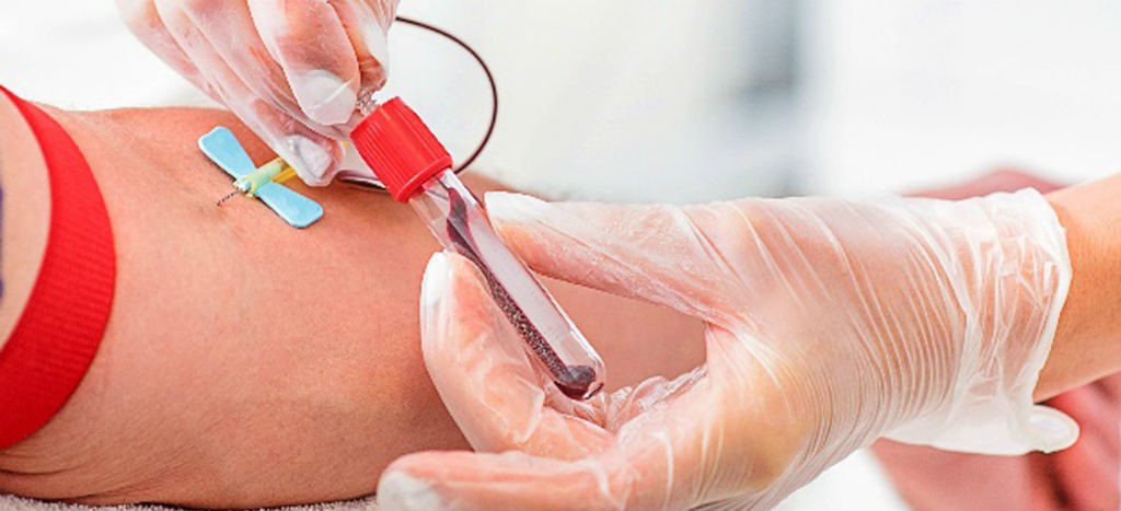 En Kinshasa, los seropositivos “esperan a estar al borde de la muerte para acudir a buscar un tratamiento”