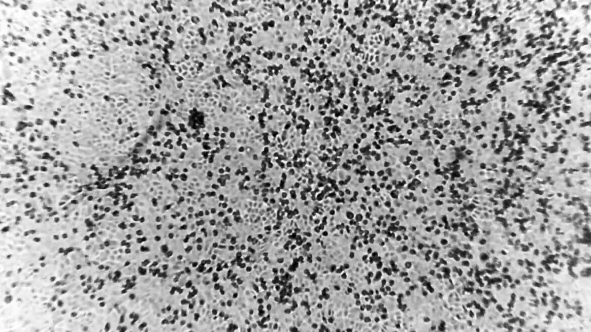 Aterrador: así se esparce por el cuerpo el mortal coronavirus