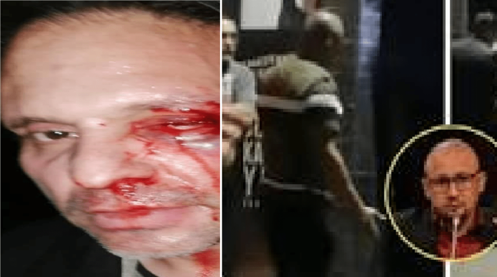 Diputado protagoniza riña en bar, golpean a ciudadano, “fueron familiares, andaban enfiestados”, dijo