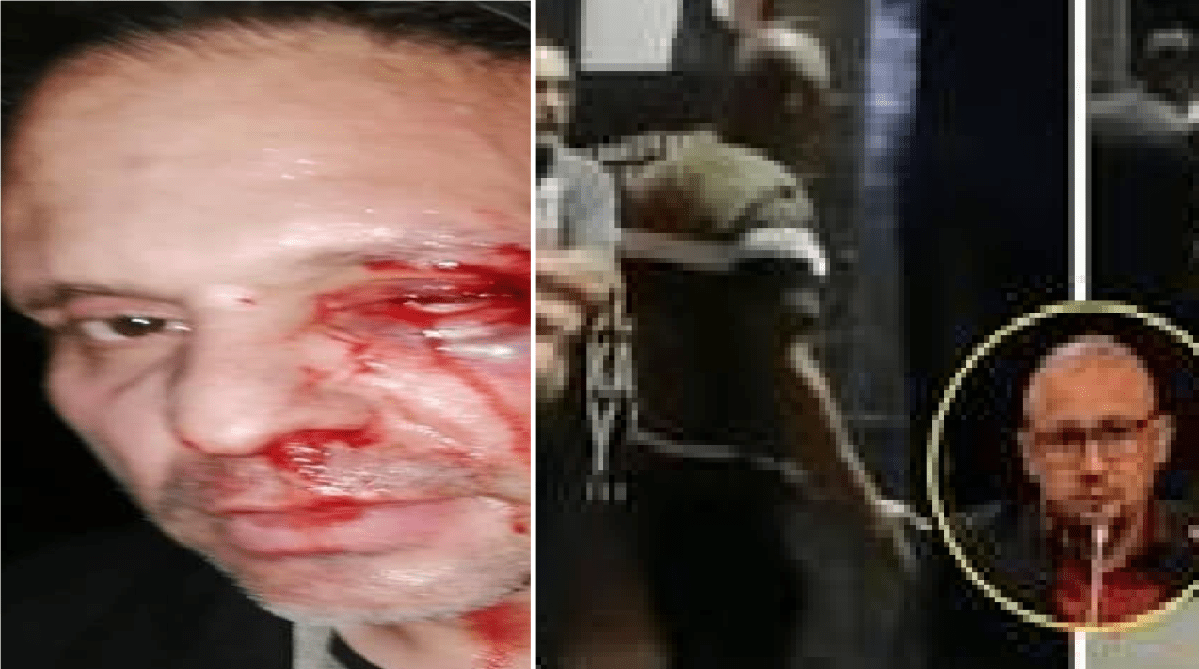 Diputado protagoniza riña en bar, golpean a ciudadano, “fueron familiares, andaban enfiestados”, dijo