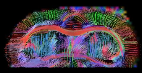 Vista axial de la conectividad cerebral de ratas. Se ve el cuerpo calloso, las comisuras anteriores y las conexiones con la materia gris. Las imágenes son de 300 micras. Vista axial de la conectividad cerebral de ratas. Se ve el cuerpo calloso, las comisuras anteriores y las conexiones con la materia gris. Las imágenes son de 300 micras.