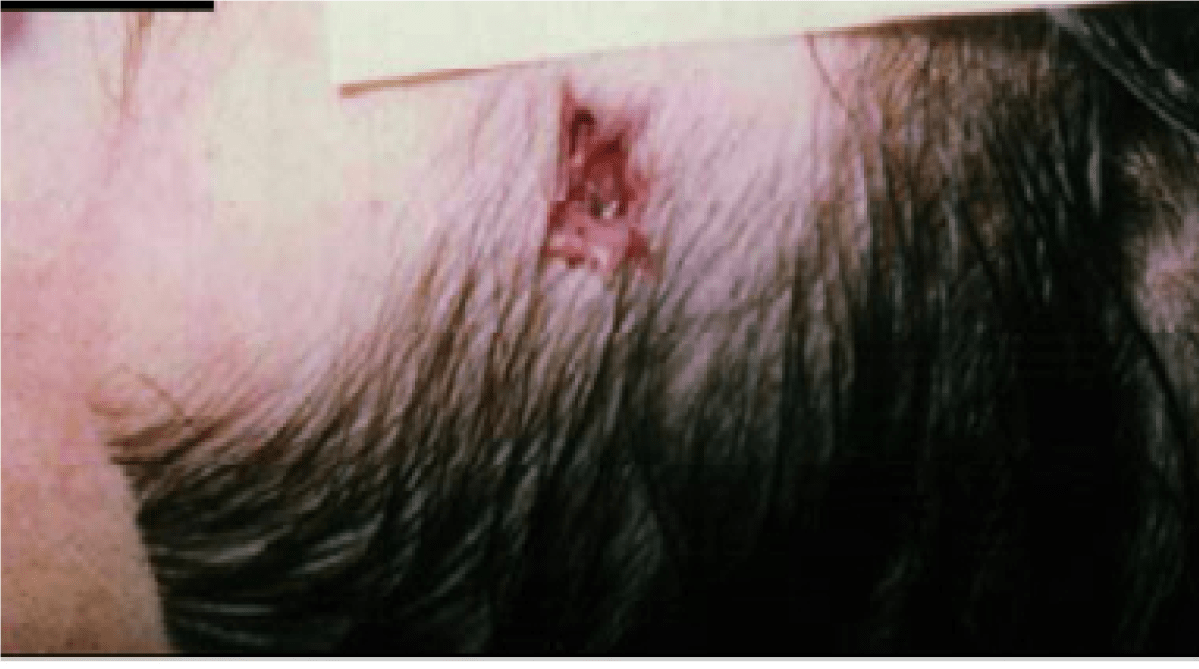 Intenta suicidarse un joven en Querétaro, se dio un balazo en la sien, en San Pedrito Peñuelas