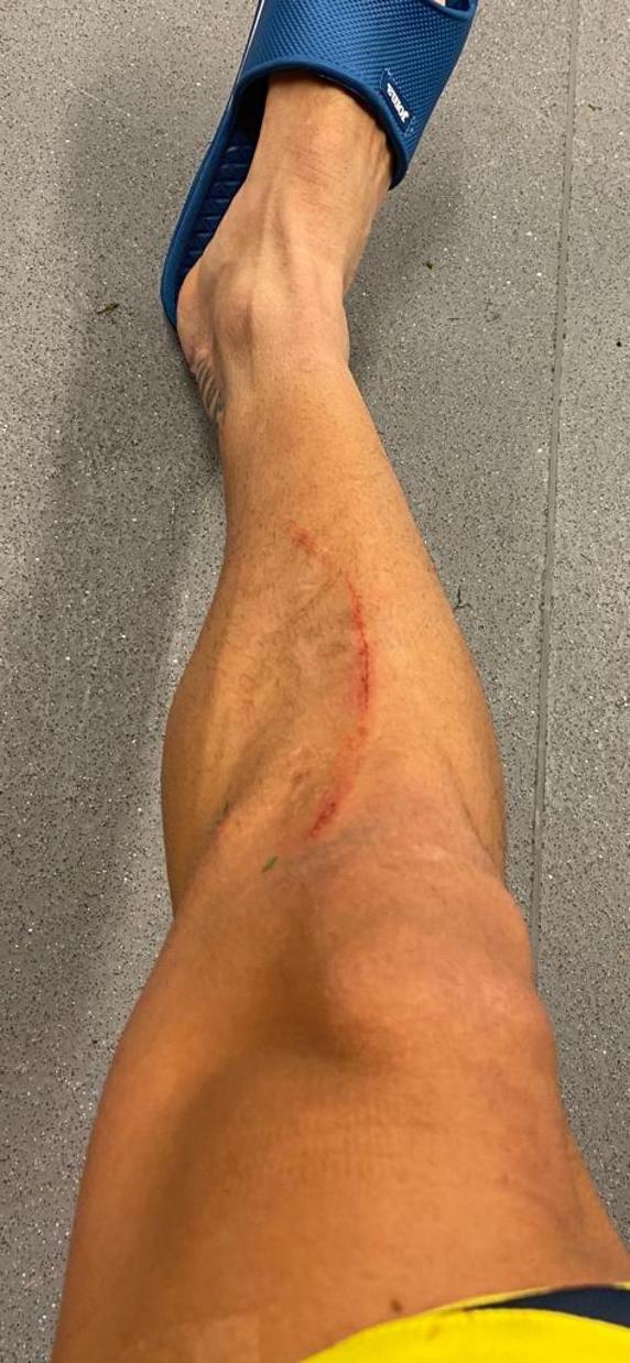 Así quedó la pierna de Cazorla tras una dura entrada de Capa