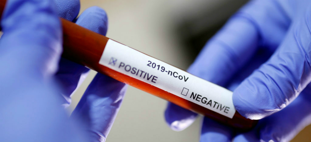 Suma Edomex seis casos positivos de Covid-19