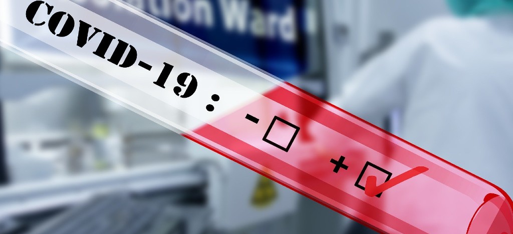 China prohíbe exportación de pruebas ‘patito’ para Covid-19