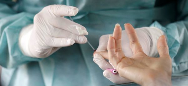 OPS llama a ampliar el número de pruebas de Covid-19 en Latinoamérica