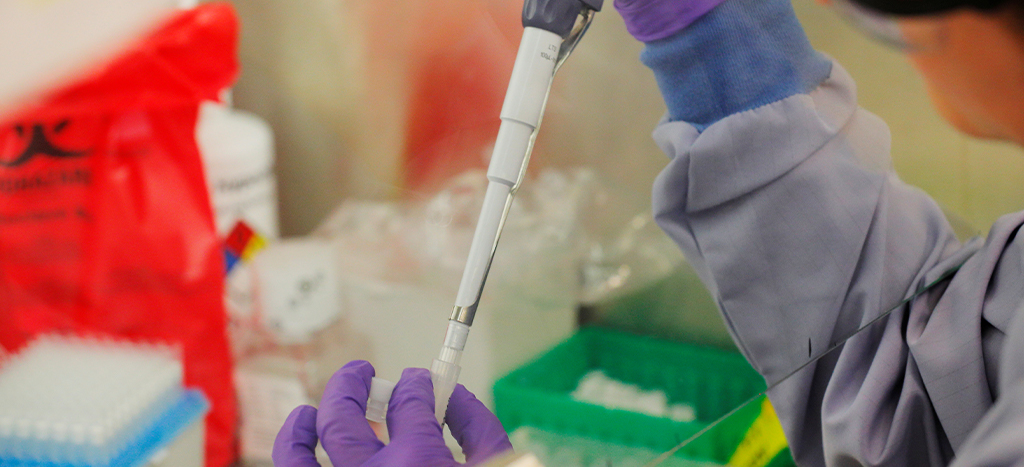 Roche consigue aprobación para prueba de anticuerpos de Covid-19