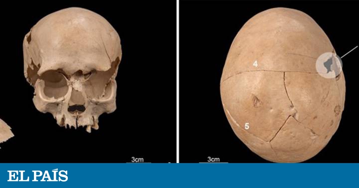 La anciana del dolmen que murió en el ‘quirófano’