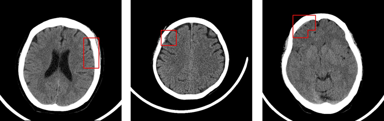 La startup taiwanesa Deep01 recauda $ 2.7 millones para su software de imágenes médicas basado en IA