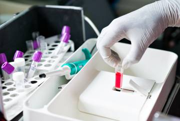 Detalle del Matiscope, el dispositivo desarrollado por Gitta y su equipo que proporciona diagnósticos sobre la malaria hasta 15 veces más rápido de los habituales. (Foto: ©Rolex Joan Bardeletti).