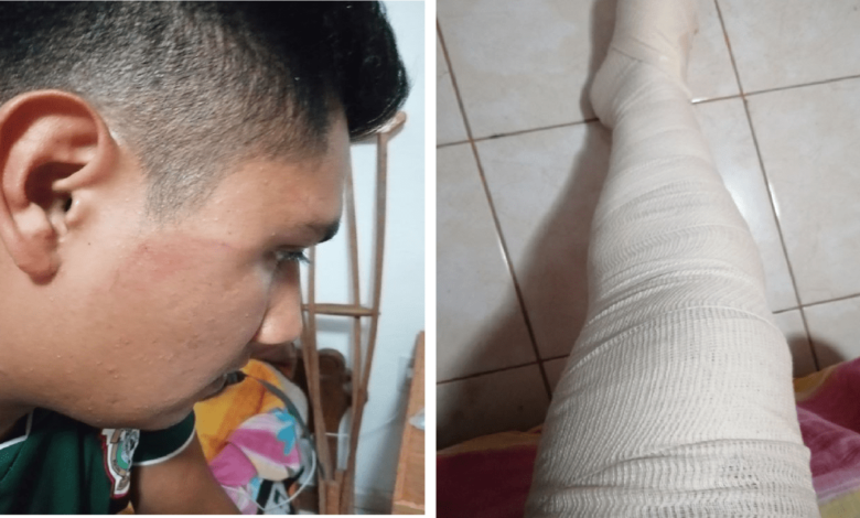 Policías de Amarildo Bárcenas siguen golpeando ciudadanos en Pedro Escobedo, un gobierno represor