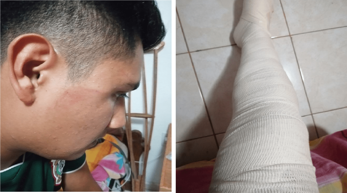 Policías de Amarildo Bárcenas siguen golpeando ciudadanos en Pedro Escobedo, un gobierno represor