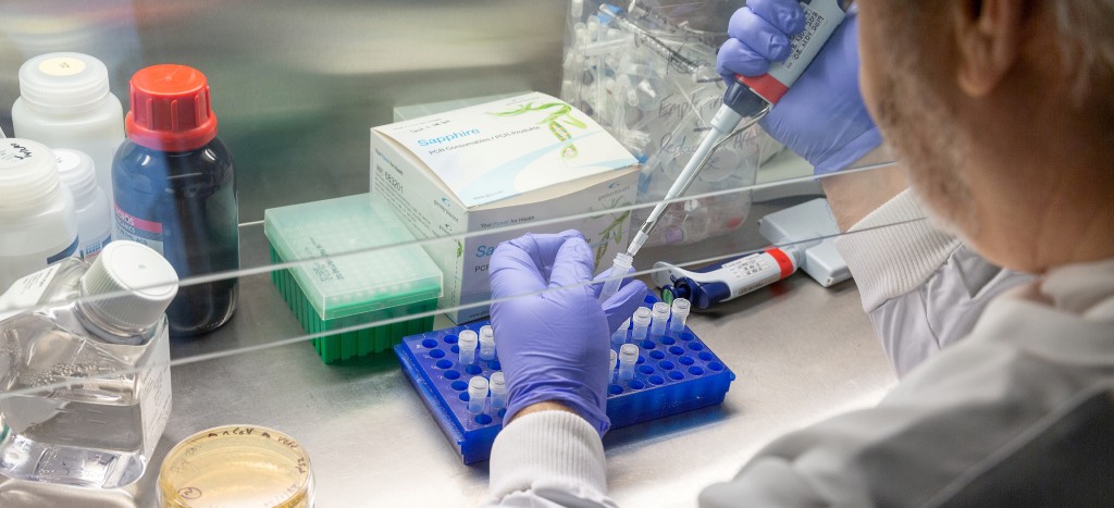 Rusia comienza ensayos clínicos en humanos de vacuna contra el coronavirus