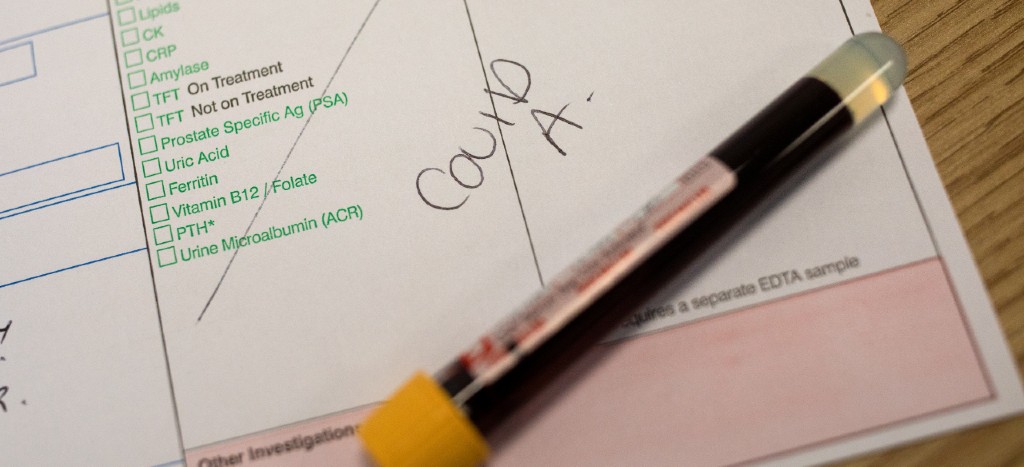 Superan los 300 mil contagios de Covid-19 en Reino Unido