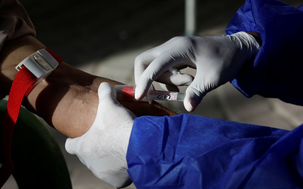 Adultos jóvenes y saludables con Covid-19 leve también tardan semanas en recuperarse: CDC