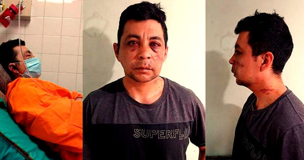 Golpean e incendian casa de enfermero contagiado de COVID, lo obligan a dejar su barrio