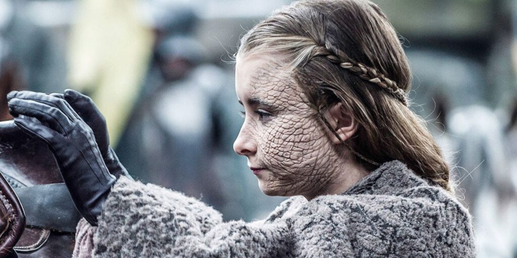 Juego de tronos: explicación en escala de grises (y cómo se puede curar)