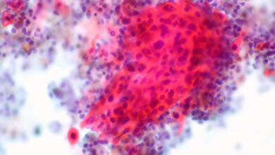 Paige, la startup de patología computacional dirigida al cáncer, cierra una Serie B a $ 70 millones