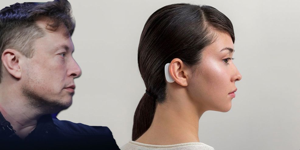 Para su próximo truco, Elon Musk transmitirá música directamente a tu cerebro